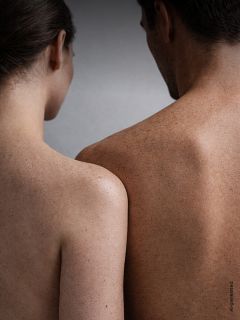 Eine Frau und ein Mann stehen Rücken an Rücken, beide ohne Hemd, und zeigen ihre sommersprossigen Schultern und Rücken vor einem neutralen Hintergrund.