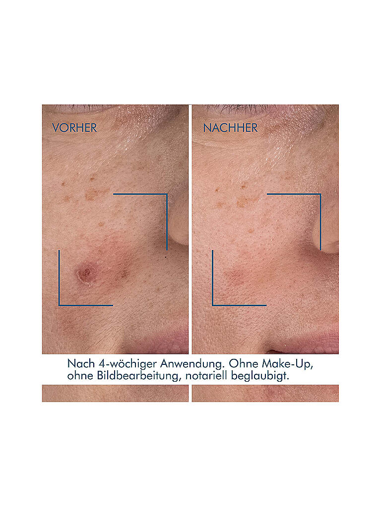 BIOTHERM Blue Retinol Resurface + Repair Night Serum 30ml keine Farbe